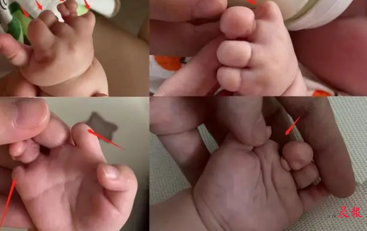 试管婴儿费用一次性支出